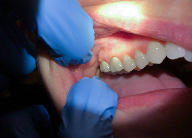 Best Emergency Dentist for Special Needs Patients in Reidville, SC